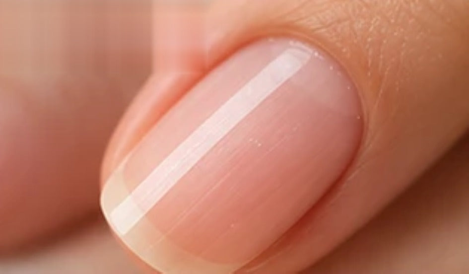 Uñas después del tratamiento (imagen referencial)